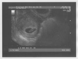 Pregnancy